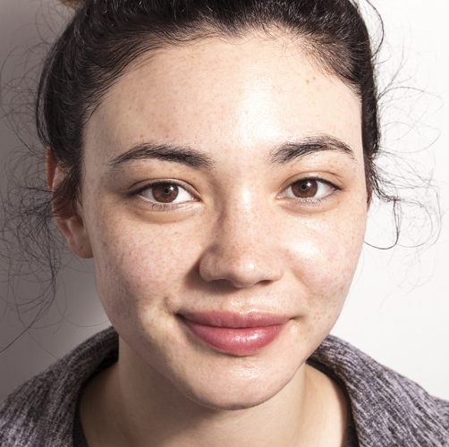 EmerginC Triple-Threat Peel